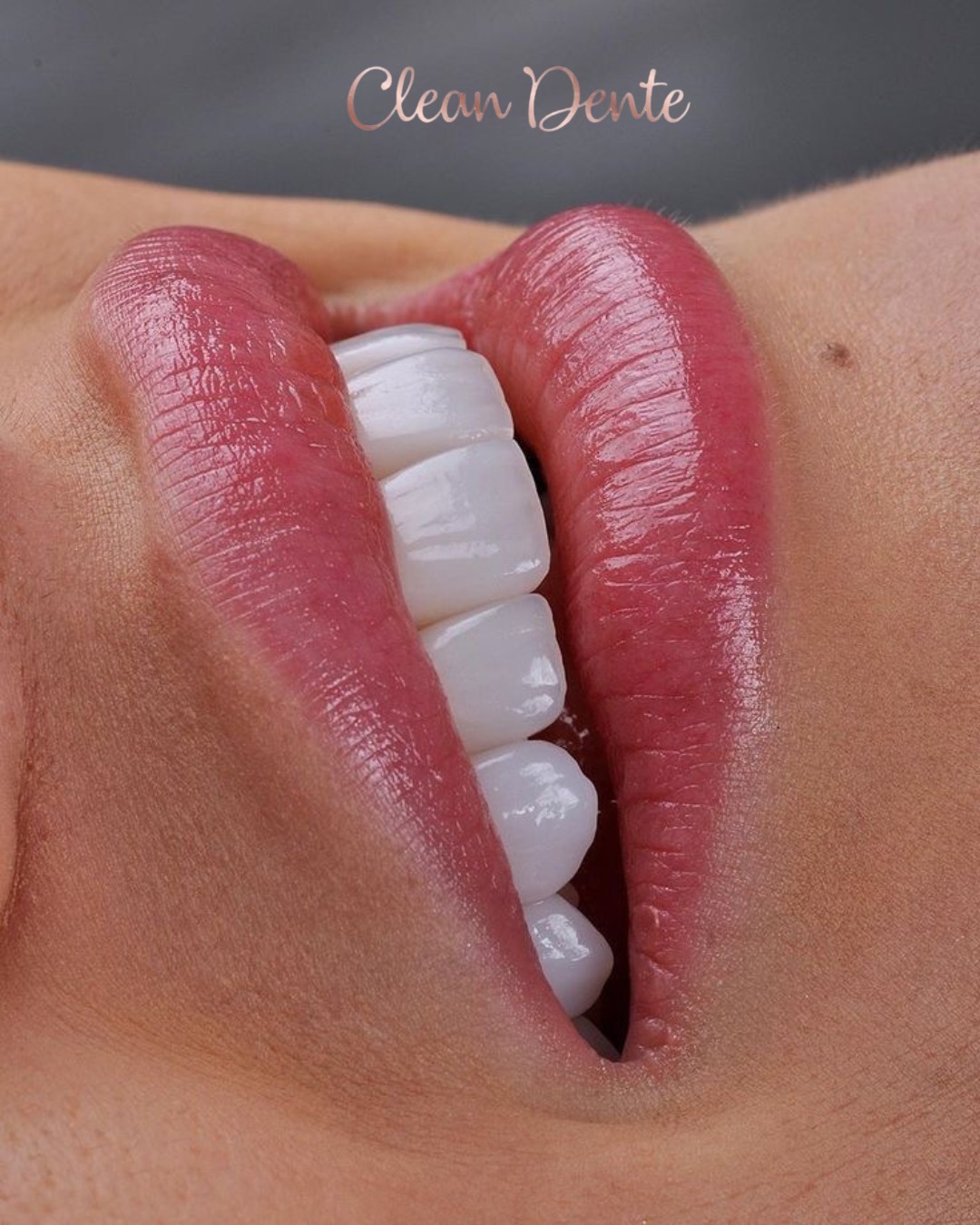Estética do Sorriso