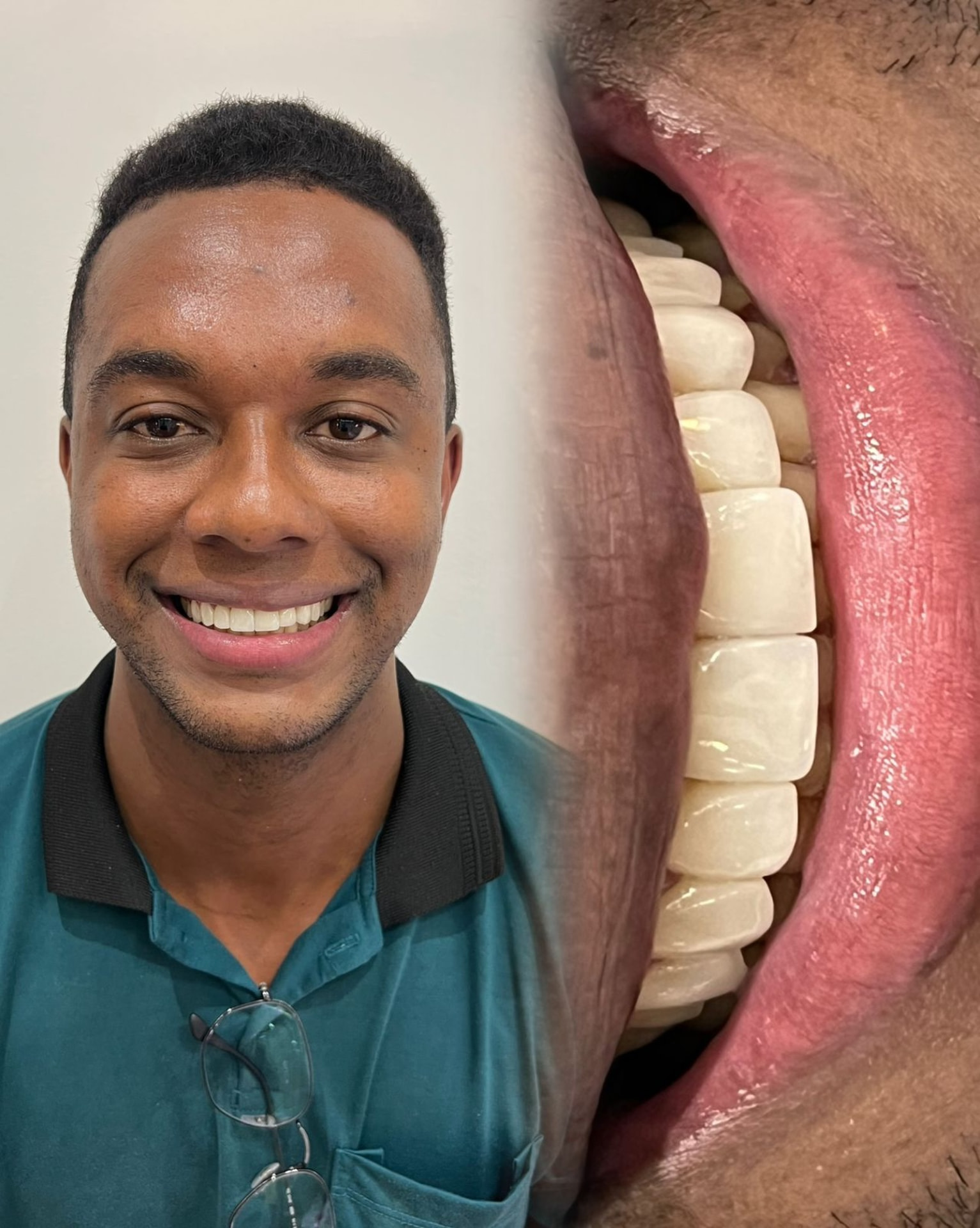 Caso real de reabilitação estética do sorriso
